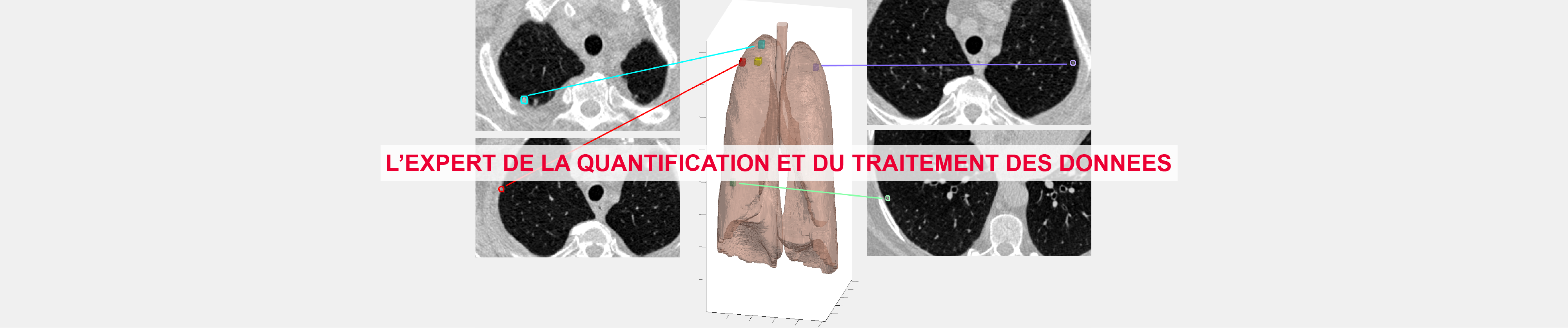 Accueil