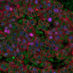 immunohistochemistry