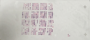 tissue microarray