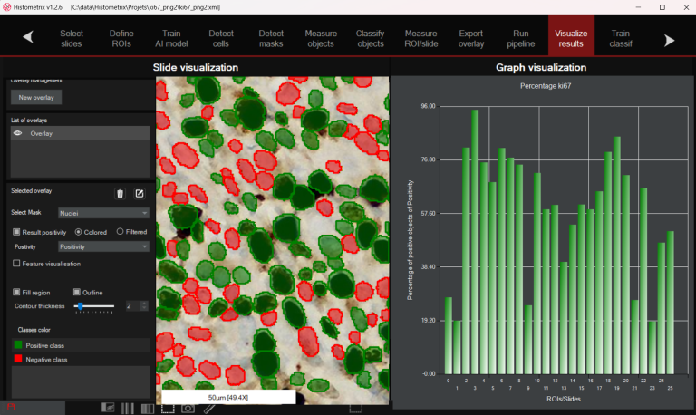 Screenshot — HistoMetriX interface: batch view with multiple slides queued, Ki67 pipeline selected, results panel