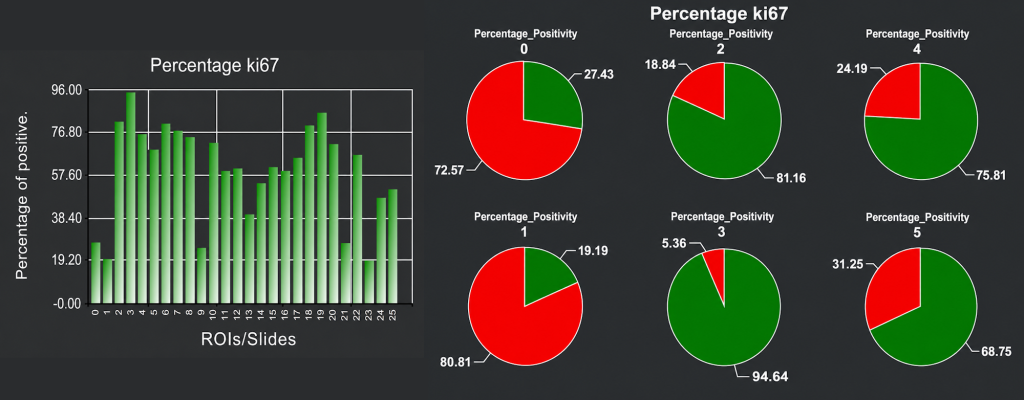 Screenshot of the HistoMetriX results page. The percentage of ki67% in displayed as bar chart and pie charts. The user can double click on chart to see corresponding slide with overlap to review the data and do quality control