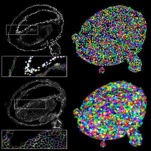 Organoid detection in 3D with cell detection and spacial analysis