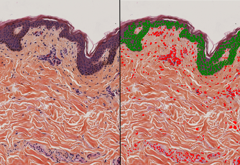 Classification of nuclei in epidermis (green) and dermis (red)