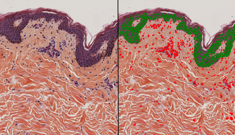 Tissue Segmentation – Skin AI tissue segmentation in skin histology images and cell classification