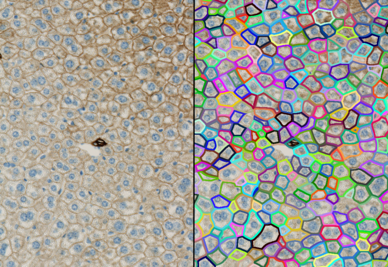 Membrane detection in brightfield condition