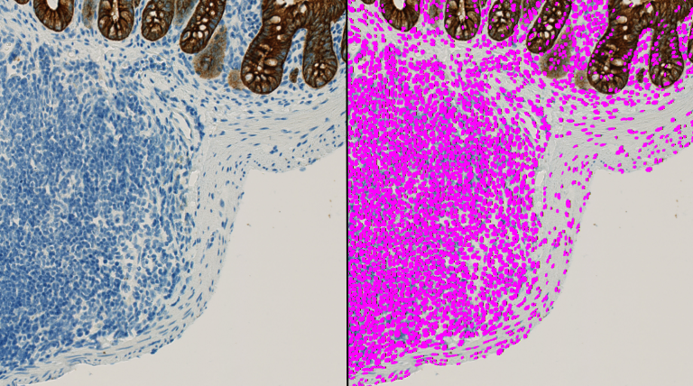 Detection of nuclei exhibiting different densities