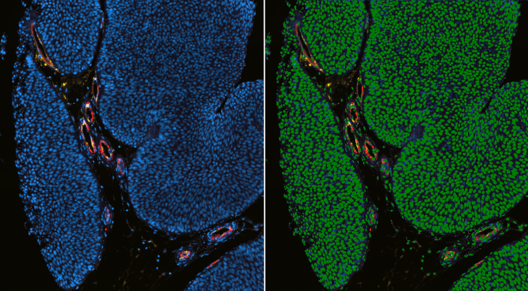 Nuclei detection with fluorescence staining (DAPI)