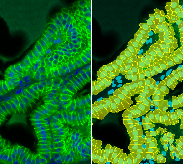 Membrane detection in fluorescence condition