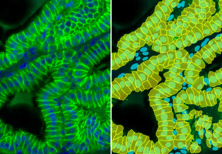 Membrane Detection – Fluorescence Cell membrane detection and segmentation in fluorescence images