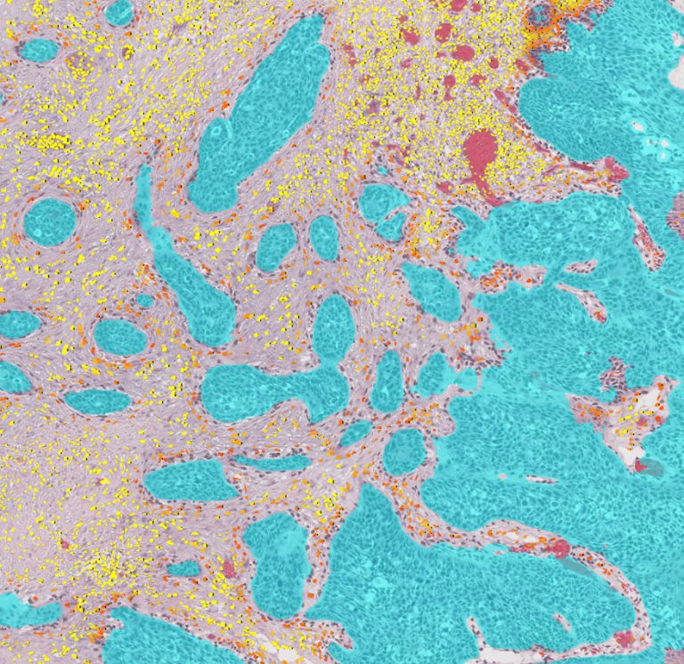 Digital pathology and quantitative histology image analysis at Montpellier University Hospital