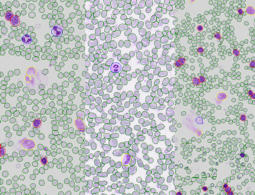 Cell Classification Hematology ML Machine learning classification of blood cell populations in histology images