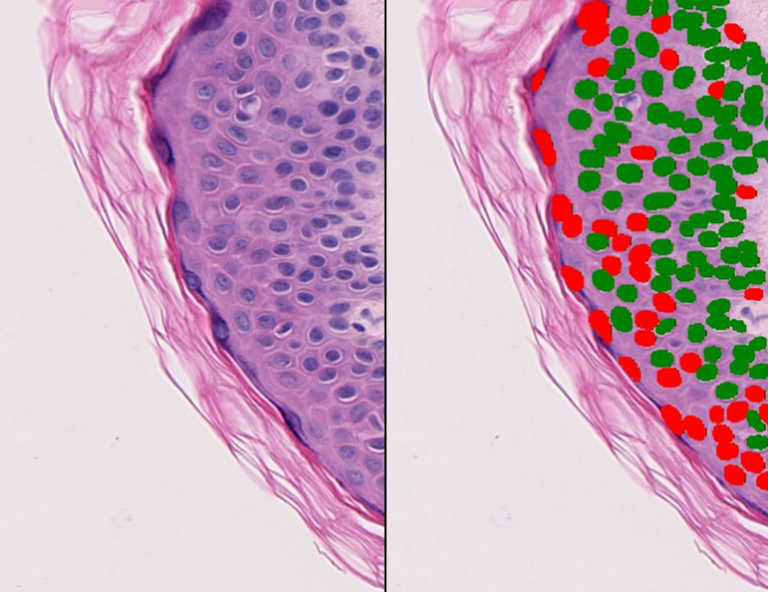 Cell Classification Vacuolization Skin Classification of vacuolated and non-vacuolated cells in skin histology