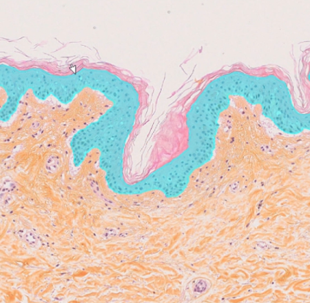 DL model Epidermis detection AI segmentation of the epidermis in skin histology images