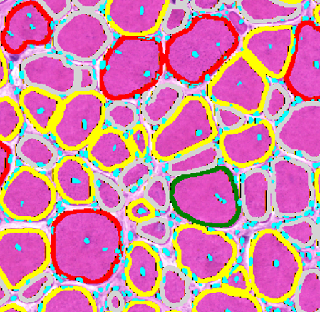 DL model Fiber detection AI detection and segmentation of muscle fibers in histology