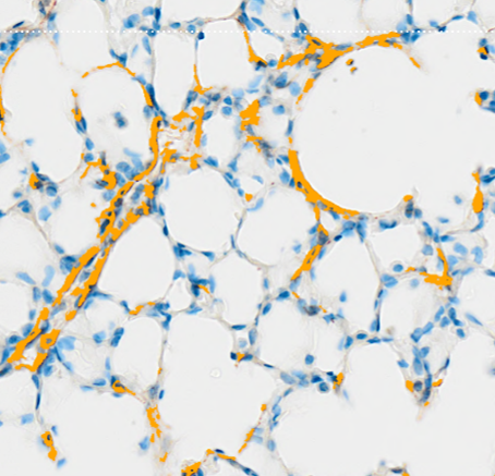 DL model Fibrosis detection AI detection and quantification of fibrosis in histology tissue