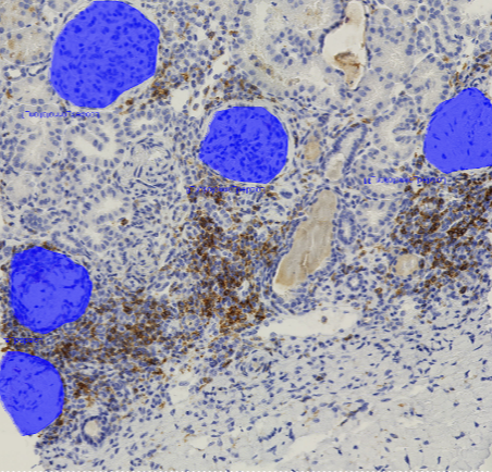 DL model Glomeruli detection AI detection and segmentation of glomeruli in kidney histology