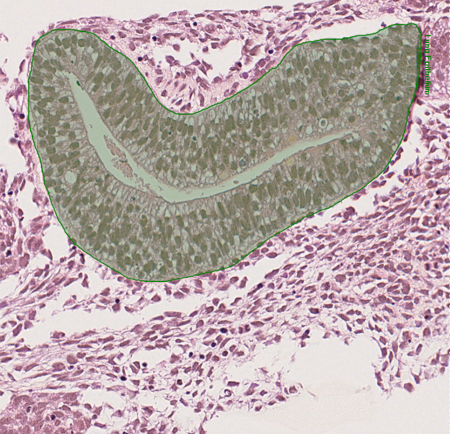 DL model Lung Epithelium detection AI segmentation of lung epithelium in histology images