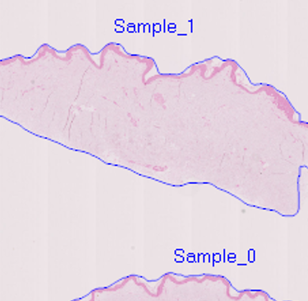 DL model Sample detection AI detection of tissue samples and regions in whole slide histology images