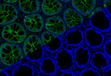 Fluorescence gut intestine