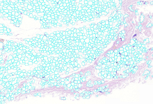 apipocytes