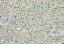 positive cell counting