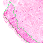 skin segmentation width estimation